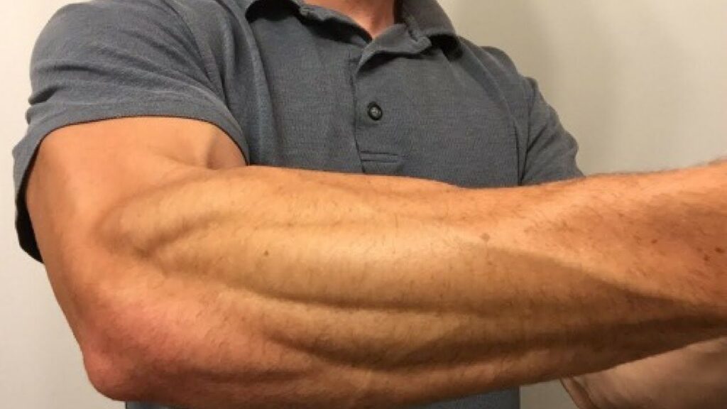 forearms